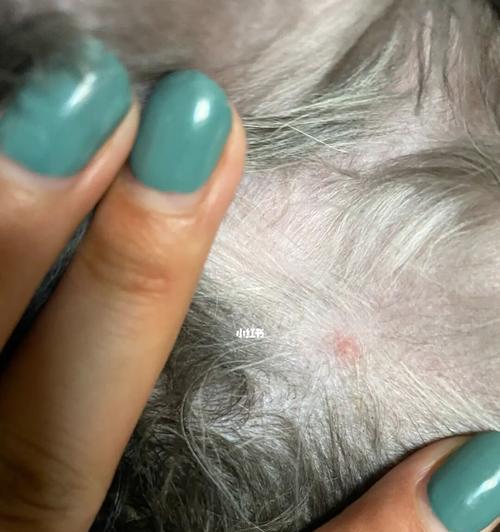 雪纳瑞的各种皮肤病详解（从病因到治疗，全面解析如何保护您的宠物）